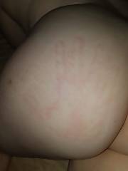 Girlfriends backside pictures Pawg Red Ass Red Arse big Booty Booty Girlfriend big Ass Ass Fat Ass big Arse Arse Spanking Handprint Ass Young Teen Sexy